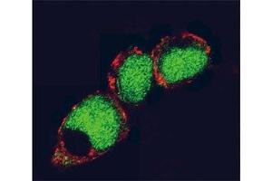 Confocal immunofluorescent analysis of EZH2 antibody and 293 cells followed by Alexa Fluor 488-conjugated goat anti-rabbit lgG (green). (EZH2 antibody)