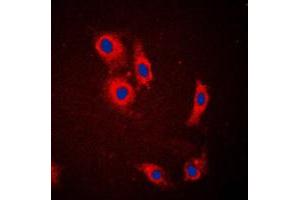 Immunofluorescent analysis of NCKX1 staining in HeLa cells. (SLC24A1 antibody  (Center))