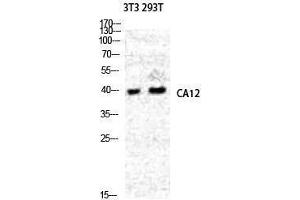 Western Blotting (WB) image for anti-Carbonic Anhydrase 12 (CA12) (Internal Region) antibody (ABIN3180517) (CA12 antibody  (Internal Region))