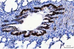 IHC analysis of CD166/ALCAM using anti-CD166/ALCAM antibody (ABIN5518801).