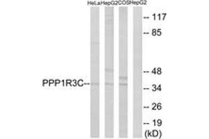 Western blot analysis of extracts from HepG2/HeLa/COS7 cells, using PPP1R3C Antibody. (PPP1R3C antibody  (AA 44-93))