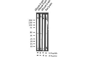 Western blot analysis of Phospho-PTP1B (Ser50) expression in various lysates (PTPN1 antibody  (pSer50))