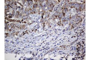 Image no. 5 for anti-NADH Dehydrogenase (Ubiquinone) 1 beta Subcomplex, 10, 22kDa (NDUFB10) antibody (ABIN1499672) (NDUFB10 antibody)