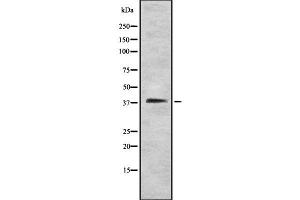 STEAP1 antibody  (N-Term)