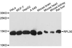 Western blot analysis of extracts of various cell lines, using RPL30 antibody. (RPL30 antibody)