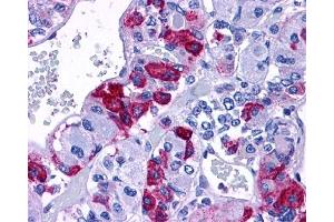 Immunohistochemistry (IHC) image for anti-Adenylate Cyclase Activating Polypeptide 1 (Pituitary) Receptor Type I (ADCYAP1R1) (N-Term) antibody (ABIN122519)