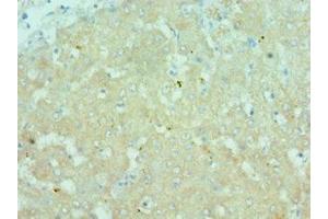 Immunohistochemistry of paraffin-embedded human liver tissue using ABIN7172781 at dilution of 1:100 (CTCFL antibody  (AA 1-270))