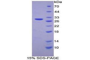 SDS-PAGE analysis of Human PSMD2 Protein. (PSMD2 Protein)