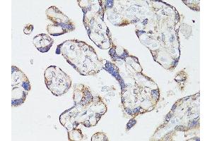 Immunohistochemistry of paraffin-embedded human placenta using MTOR antibody. (MTOR antibody  (AA 2388-2487))