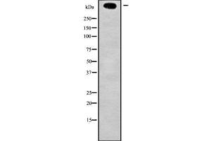 Western blot analysis of MLL2 using Jurkat whole cell lysates (Lysine (K)-Specific Methyltransferase 2B (KMT2B) (Internal Region) antibody)