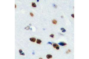 Immunohistochemical analysis of RPS19BP1 staining in human brain formalin fixed paraffin embedded tissue section. (RPS19BP1 antibody  (Center))
