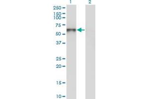 Western Blot analysis of UNC5CL expression in transfected 293T cell line by UNC5CL monoclonal antibody (M03), clone 3G7. (UNC5CL antibody  (AA 1-518))