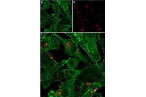 Live cell imaging of α-Conotoxin GI-ATTO Fluor-647N in live intact human AC16 cells. (alpha-conotoxin GI peptide (Atto 647N))
