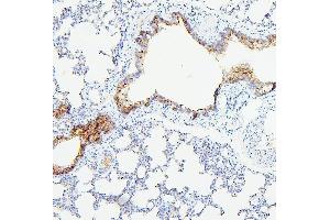 IHC analysis of TEK using anti-TEK antibody (ABIN7600762). (TEK antibody  (AA 23-616))