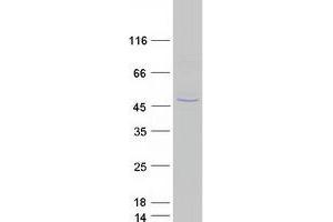 Western Blotting (WB) image for PIH1 Domain Containing 2 (PIH1D2) (Transcript Variant 1) protein (Myc-DYKDDDDK Tag) (ABIN2728899)