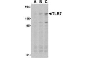 Western blot analysis of TLR7 in Daudi cell lysates with this product at (A) 0. (TLR7 antibody  (Middle Region))