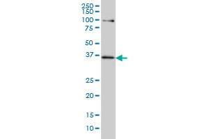 Western Blotting (WB) image for anti-Transcription Factor 19 (TCF19) (AA 17-103) antibody (ABIN598965) (TCF19 antibody  (AA 17-103))