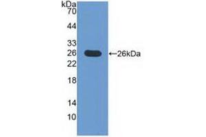 Detection of Recombinant ICOSLG, Mouse using Polyclonal Antibody to Inducible T-Cell Co Stimulator Ligand (ICOSLG) (ICOSLG antibody  (AA 58-249))
