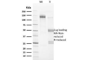 SDS-PAGE (SDS) image for anti-Vinculin (VCL) (AA 174-322) antibody (ABIN6940864)