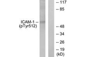 Western blot analysis of extracts from HeLa cells treated with TNF-alpha 20ng/ml 5', using ICAM-1 (Phospho-Tyr512) Antibody. (ICAM1 antibody  (pTyr512))