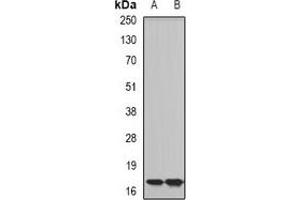 Western blot analysis of Complexin-2 expression in SHSY5Y (A), mouse eye (B) whole cell lysates.