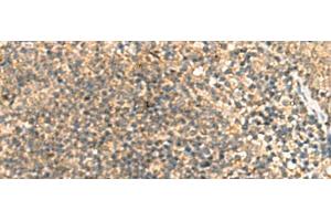 Immunohistochemistry of paraffin-embedded Human tonsil tissue using TCAP Polyclonal Antibody at dilution of 1:55(x200) (TCAP antibody)