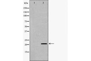 Western blot analysis UBE2M using COLO205 whole cell lysates (UBE2M antibody  (Internal Region))