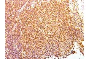 FACS testing of HeLa cells: Black=no Ab (Nuclear Antigen antibody)