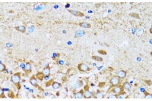 Immunohistochemistry (Paraffin-embedded Sections) (IHC (p)) image for anti-Actin-Related Protein 2 (ACTR2) antibody (ABIN7261690)