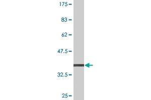 Western Blot detection against Immunogen (38. (SH2D3A antibody  (AA 460-575))