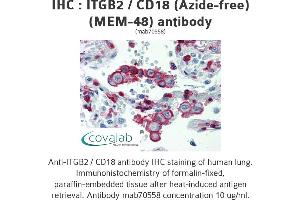Image no. 1 for anti-Integrin beta 2 (ITGB2) antibody (ABIN1723416) (Integrin beta 2 antibody)