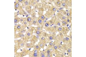 Immunohistochemistry of paraffin-embedded human liver injury using GPD2 Antibody. (GPD2 antibody  (AA 25-325))