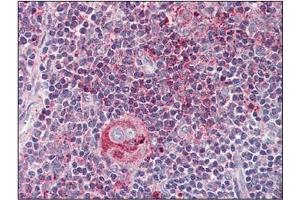 Immunohistochemistry: WNT5B antibody staining of Formalin-Fixed, Paraffin-Embedded Human Thymus. (WNT5B antibody)