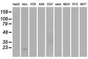 Image no. 2 for anti-Adenylate Kinase 1 (AK1) antibody (ABIN1496514) (Adenylate Kinase 1 antibody)