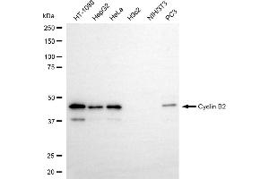 Western blotting analysis using cyclin B2 antibody (ABIN7798193).