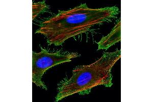 Fluorescent image of Hela cells stained with FA Antibody (Center) (ABIN1881332 and ABIN2843378). (FAM159A antibody  (AA 89-115))