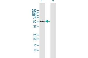 PRAME antibody  (AA 1-509)