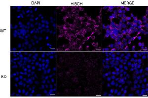 anti-3-hydroxyisobutyryl-CoA Hydrolase (HIBCH) antibody