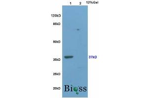 L1 rat brain, L2 mouse uterus lysates probed (ABIN733178) at 1:200 in 4 °C. (WNT3A antibody  (AA 281-352))