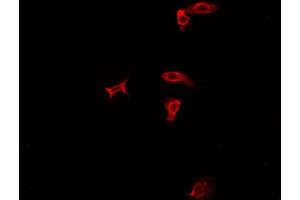 ABIN6277935 staining HepG2? (PRMT7 antibody  (Internal Region))