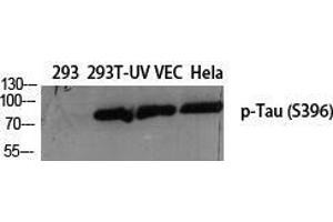 Western Blot (WB) analysis of specific cells using Phospho-Tau (S396) Polyclonal Antibody. (tau antibody  (pSer396))