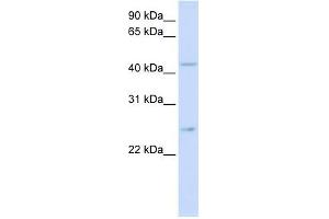 SLC37A4 antibody used at 1 ug/ml to detect target protein. (SLC37A4 antibody)