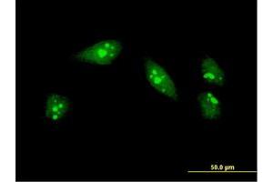 Immunofluorescence of monoclonal antibody to MEOX1 on HeLa cell.
