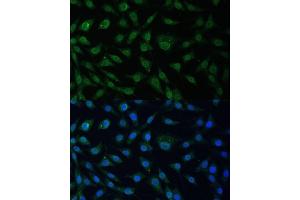 Immunofluorescence analysis of L929 cells using NUP214 Polyclonal Antibody (ABIN6127536, ABIN6144958, ABIN6144959 and ABIN6224385) at dilution of 1:100 (40x lens).