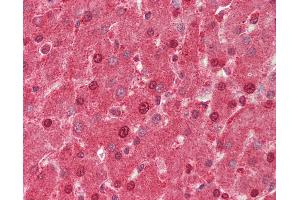 Human Liver: Formalin-Fixed, Paraffin-Embedded (FFPE). (AIRE antibody  (N-Term))