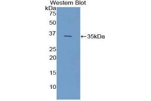 Western Blotting (WB) image for anti-Ficolin (Collagen/fibrinogen Domain Containing) 1 (FCN1) (AA 25-317) antibody (ABIN3207865) (FCN1 antibody  (AA 25-317))