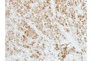 IHC-P Image Immunohistochemical analysis of paraffin-embedded TOV-21G xenograft, using AP4M1, antibody at 1:500 dilution. (AP4M1 antibody  (Center))