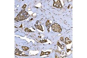 IHC analysis of SAP130 using anti-SAP130 antibody (ABIN7601247). (SAP130 antibody  (AA 309-913))