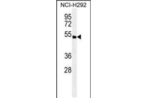 Western blot analysis in NCI-H292 cell line lysates (35ug/lane). (ABHD8 antibody  (C-Term))
