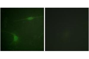 Immunofluorescence analysis of NIH-3T3 cells, using JIP1 (Phospho-Thr103) Antibody. (MAPK8IP1 antibody  (pThr103))